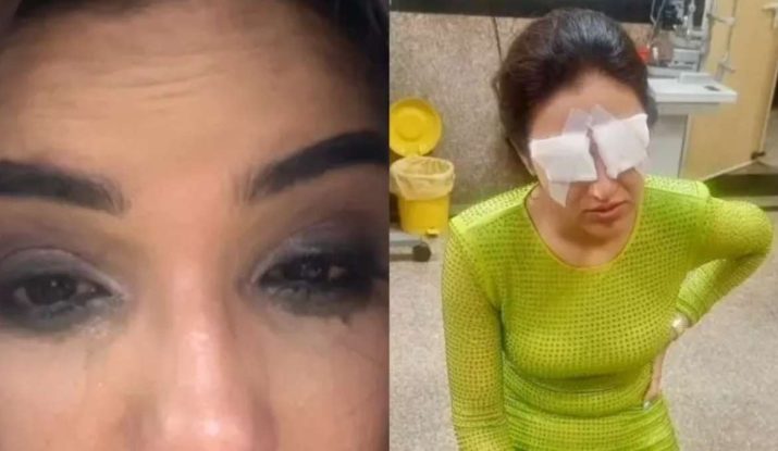 jasmine bhasin contect lens