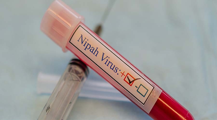 Nipah virus